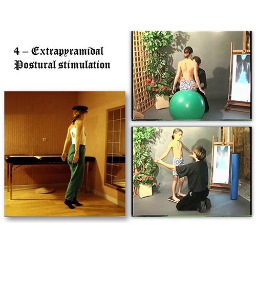 Stimulation-extrapyramidale