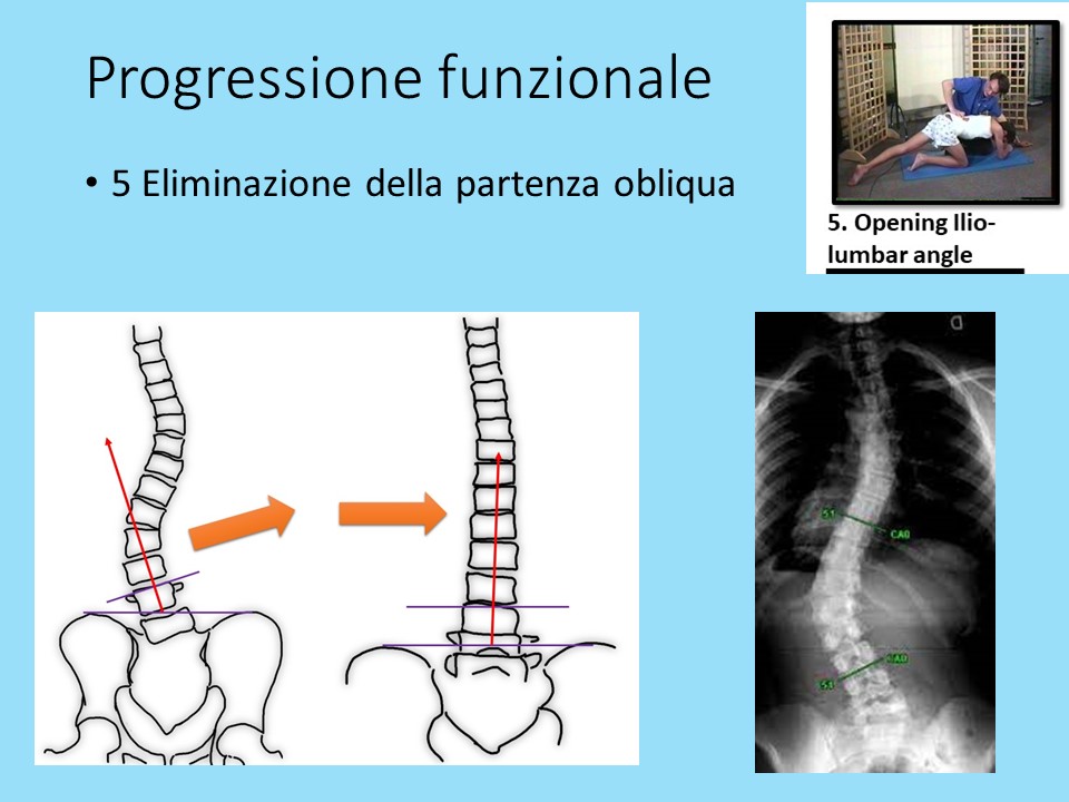 Slide25