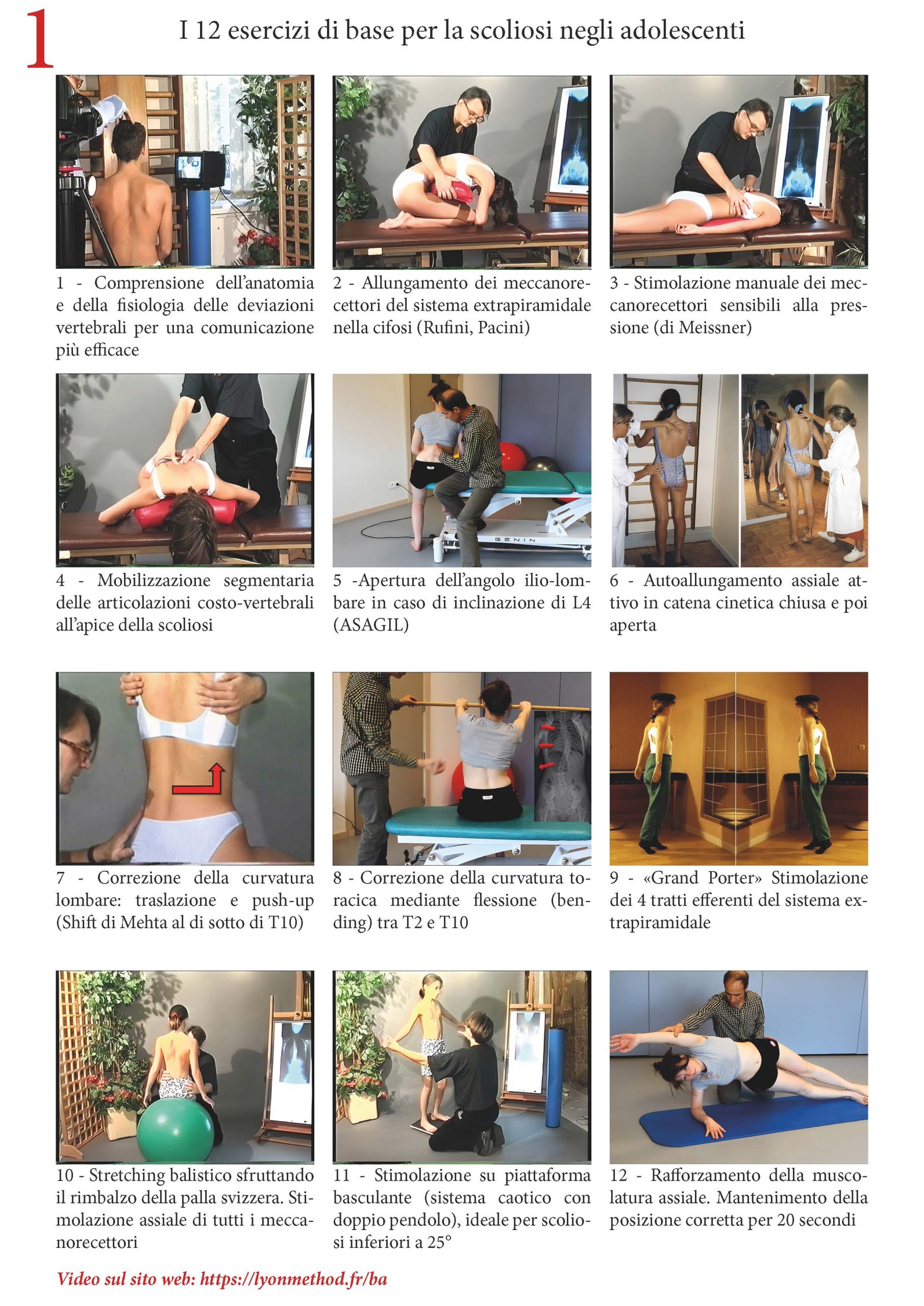 12 Esercizi di base per la scoliosi adolescenziale.Bari