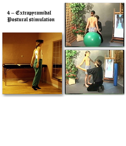 Stimulation extrapyramidale