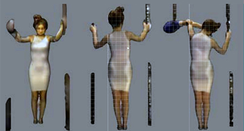 Moulage-regional-en-position-corrigee