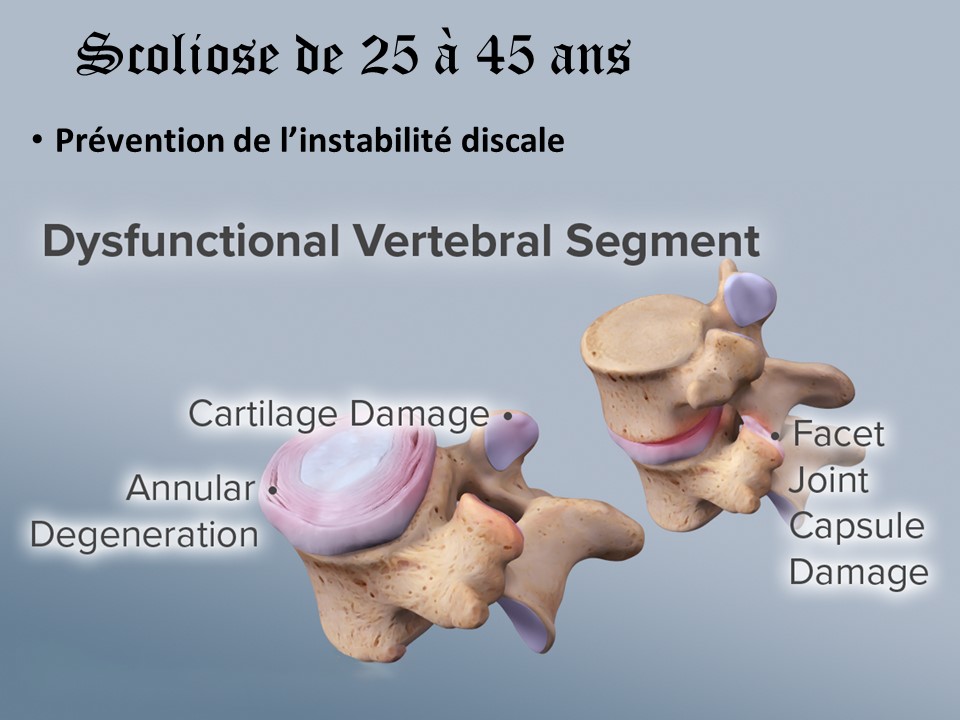 21C (26)