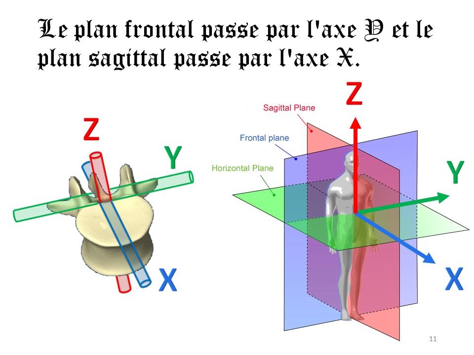 Slide11 Slide11