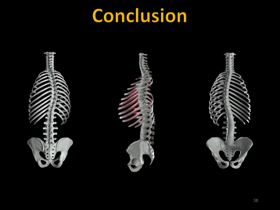 Slide38 Slide38