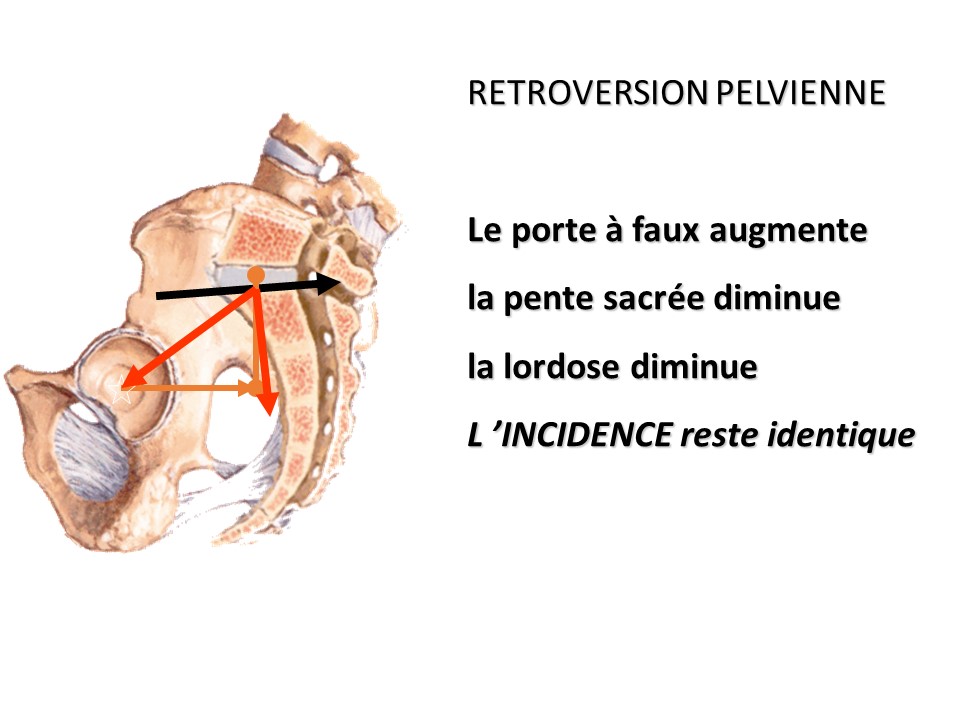 Slide5 Slide5